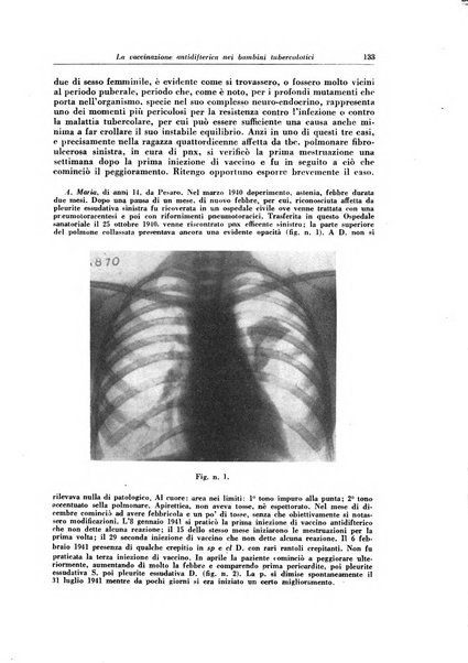 Rivista di patologia e clinica della tubercolosi organo ufficiale della Società italiana fascista di studi scientifici sulla tubercolosi