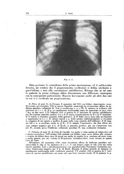 Rivista di patologia e clinica della tubercolosi organo ufficiale della Società italiana fascista di studi scientifici sulla tubercolosi