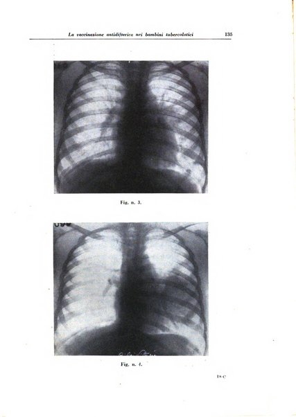 Rivista di patologia e clinica della tubercolosi organo ufficiale della Società italiana fascista di studi scientifici sulla tubercolosi