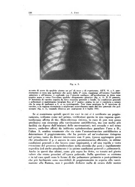 Rivista di patologia e clinica della tubercolosi organo ufficiale della Società italiana fascista di studi scientifici sulla tubercolosi