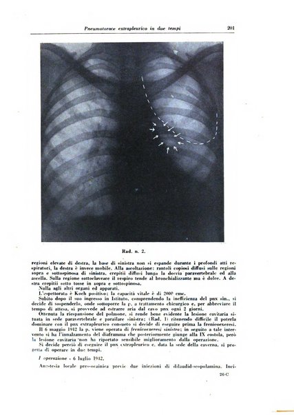 Rivista di patologia e clinica della tubercolosi organo ufficiale della Società italiana fascista di studi scientifici sulla tubercolosi