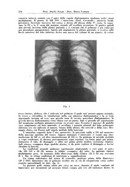 Rivista di patologia e clinica della tubercolosi organo ufficiale della Società italiana fascista di studi scientifici sulla tubercolosi