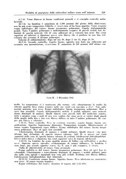 Rivista di patologia e clinica della tubercolosi organo ufficiale della Società italiana fascista di studi scientifici sulla tubercolosi