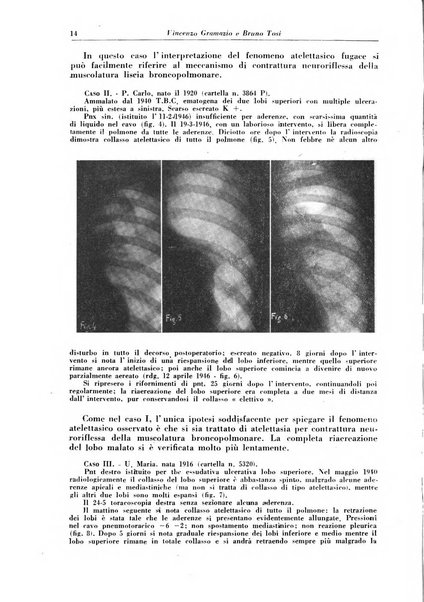 Rivista di patologia e clinica della tubercolosi organo ufficiale della Società italiana fascista di studi scientifici sulla tubercolosi