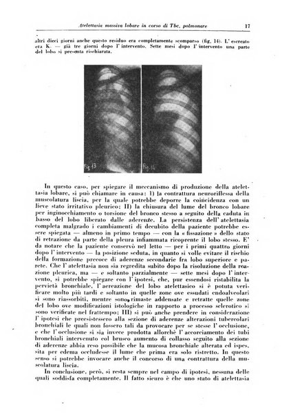 Rivista di patologia e clinica della tubercolosi organo ufficiale della Società italiana fascista di studi scientifici sulla tubercolosi