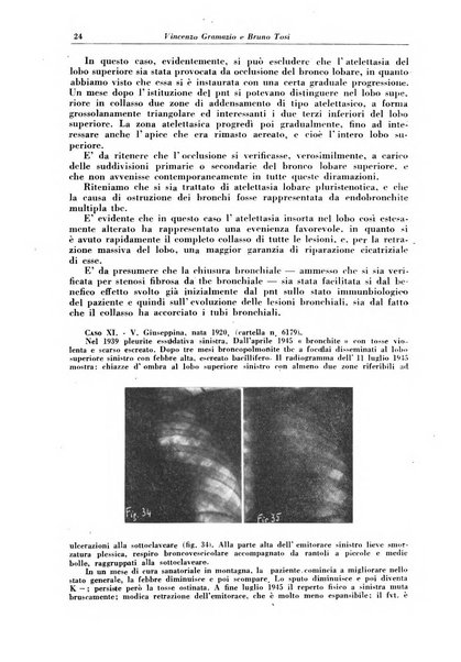 Rivista di patologia e clinica della tubercolosi organo ufficiale della Società italiana fascista di studi scientifici sulla tubercolosi