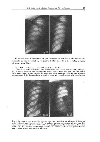 Rivista di patologia e clinica della tubercolosi organo ufficiale della Società italiana fascista di studi scientifici sulla tubercolosi