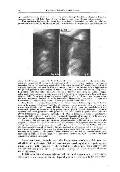 Rivista di patologia e clinica della tubercolosi organo ufficiale della Società italiana fascista di studi scientifici sulla tubercolosi