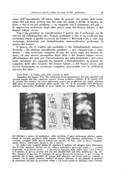 Rivista di patologia e clinica della tubercolosi organo ufficiale della Società italiana fascista di studi scientifici sulla tubercolosi