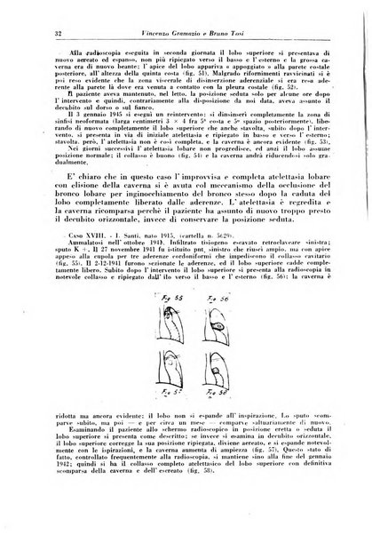 Rivista di patologia e clinica della tubercolosi organo ufficiale della Società italiana fascista di studi scientifici sulla tubercolosi