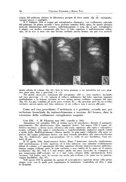 Rivista di patologia e clinica della tubercolosi organo ufficiale della Società italiana fascista di studi scientifici sulla tubercolosi