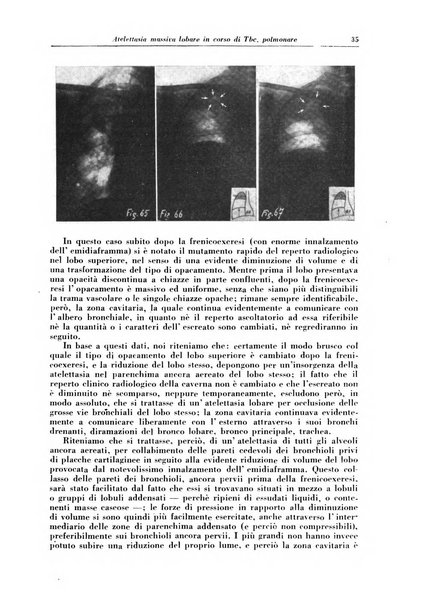 Rivista di patologia e clinica della tubercolosi organo ufficiale della Società italiana fascista di studi scientifici sulla tubercolosi