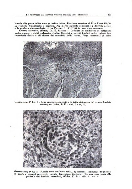 Rivista di patologia e clinica della tubercolosi organo ufficiale della Società italiana fascista di studi scientifici sulla tubercolosi