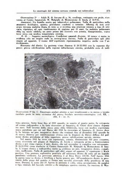 Rivista di patologia e clinica della tubercolosi organo ufficiale della Società italiana fascista di studi scientifici sulla tubercolosi