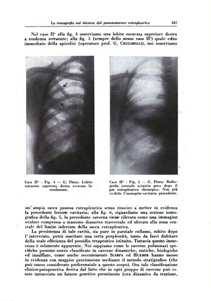 Rivista di patologia e clinica della tubercolosi organo ufficiale della Società italiana fascista di studi scientifici sulla tubercolosi