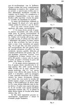 giornale/PUV0113486/1936/unico/00000393