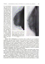 giornale/PUV0113779/1937/unico/00000075