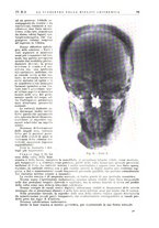 giornale/PUV0113779/1937/unico/00000117
