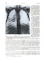 giornale/PUV0113779/1937/unico/00000118
