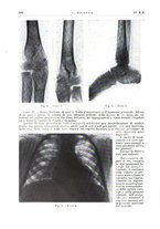 giornale/PUV0113779/1937/unico/00000120