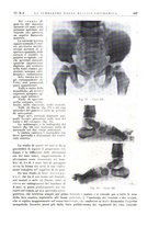 giornale/PUV0113779/1937/unico/00000125