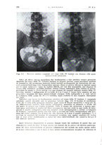 giornale/PUV0113779/1937/unico/00000266
