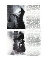 giornale/PUV0113779/1937/unico/00000276