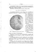 giornale/PUV0114683/1925/v.1/00000082