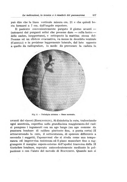 Archivio italiano di urologia