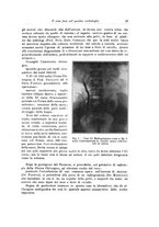 giornale/PUV0114683/1925/v.2/00000033