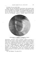 giornale/PUV0114683/1925/v.2/00000153