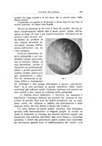 giornale/PUV0114683/1925/v.2/00000387