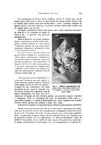 giornale/PUV0114683/1928-1929/unico/00000327