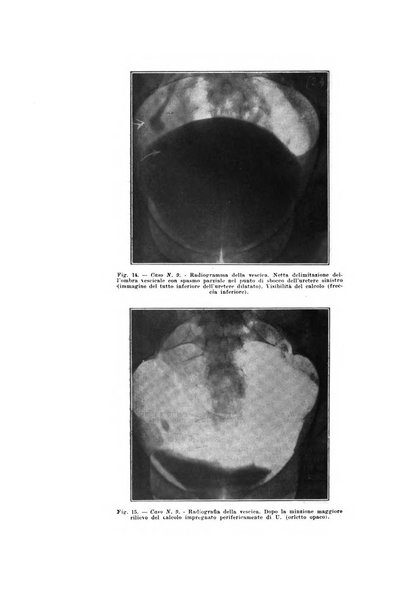 Archivio italiano di urologia