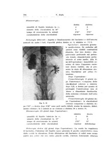 Archivio italiano di urologia