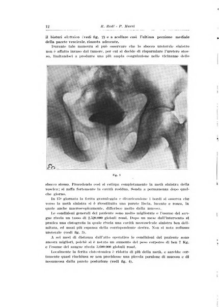 Archivio italiano di urologia