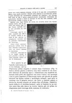 giornale/PUV0114683/1933/unico/00000383