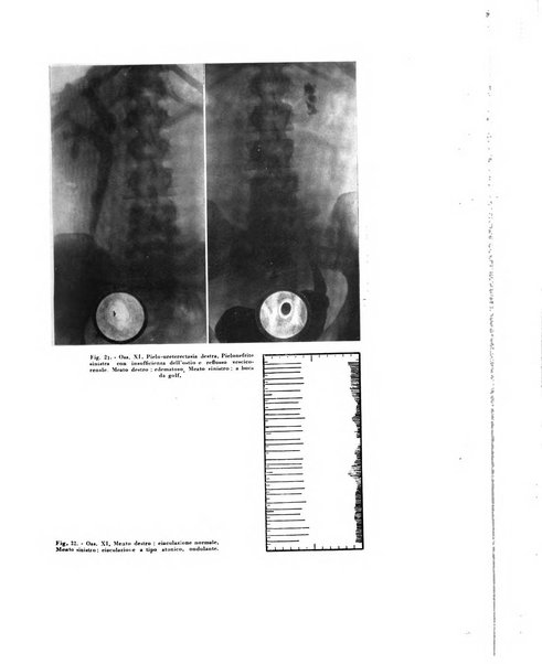 Archivio italiano di urologia