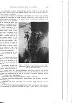 giornale/PUV0114683/1935/unico/00000479