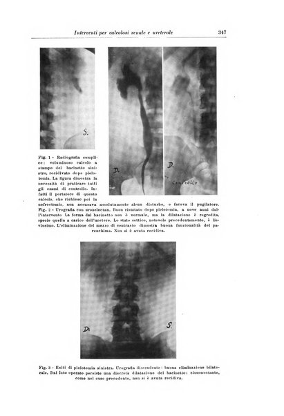 Archivio italiano di urologia