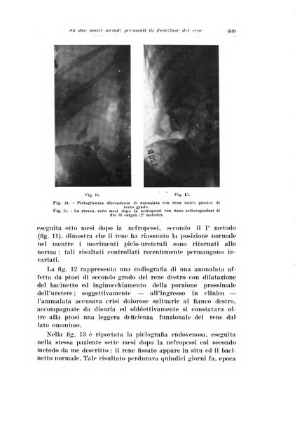 Archivio italiano di urologia