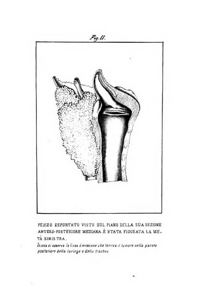 Archivii italiani di laringologia periodico trimestrale