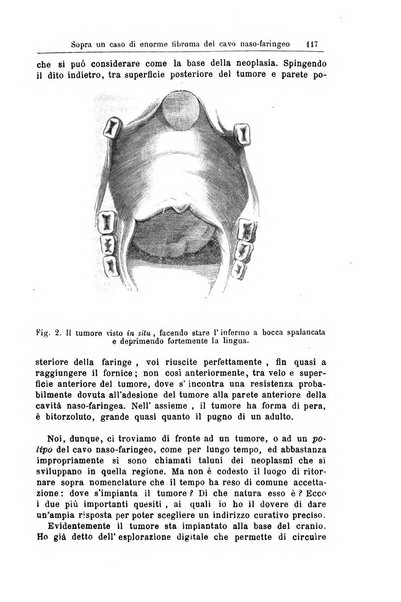 Archivii italiani di laringologia periodico trimestrale