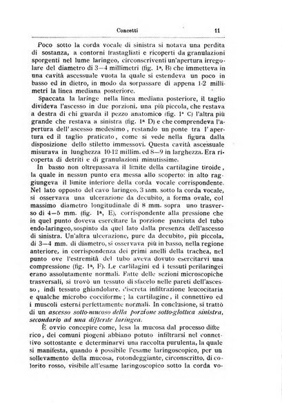 Archivii italiani di laringologia periodico trimestrale