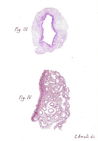 Archivii italiani di laringologia periodico trimestrale