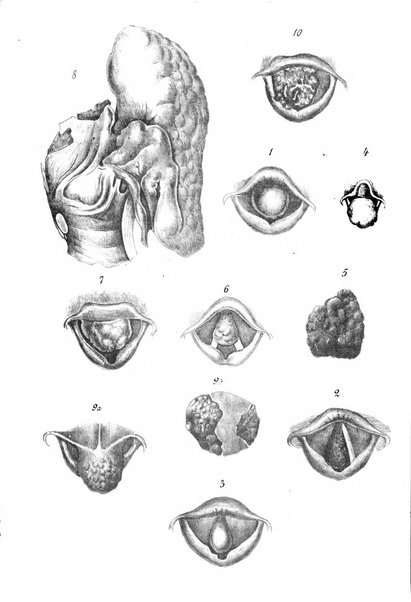 Archivii italiani di laringologia periodico trimestrale