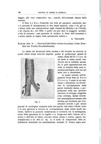 giornale/PUV0115303/1911/unico/00000092