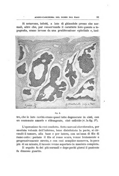 Archivii italiani di laringologia periodico trimestrale