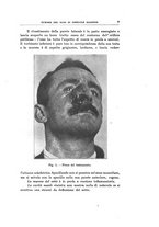 giornale/PUV0115303/1934-1935/unico/00000013