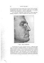 giornale/PUV0115303/1934-1935/unico/00000018
